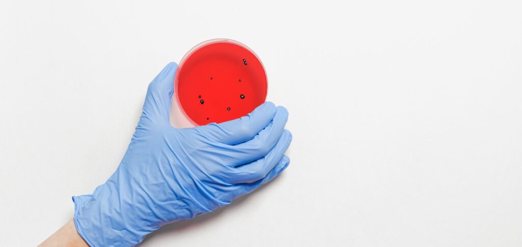 Hand Holding Petri Dish